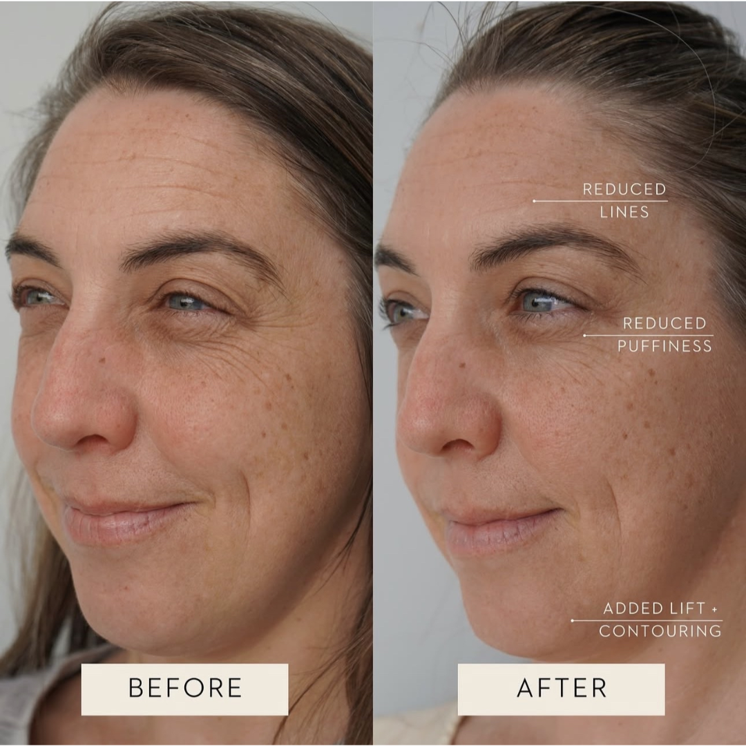 Aeki Lymphatic Drainage Supplement